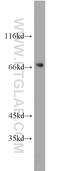 Phosphoglucomutase 2 antibody, 11022-1-AP, Proteintech Group, Western Blot image 