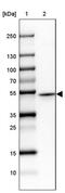 Protein Kinase CAMP-Dependent Type I Regulatory Subunit Alpha antibody, PA5-62112, Invitrogen Antibodies, Western Blot image 