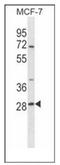 SRP Receptor Subunit Beta antibody, AP54047PU-N, Origene, Western Blot image 