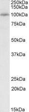 Troponin I3, Cardiac Type antibody, 43-244, ProSci, Western Blot image 