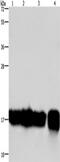 Interleukin 17C antibody, TA351281, Origene, Western Blot image 