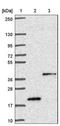 Transmembrane Protein 120B antibody, NBP1-91101, Novus Biologicals, Western Blot image 