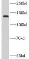 Regulator of telomere elongation helicase 1 antibody, FNab07517, FineTest, Western Blot image 