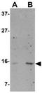 Norrin antibody, GTX85292, GeneTex, Western Blot image 