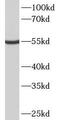 Methyltransferase Like 4 antibody, FNab09913, FineTest, Western Blot image 