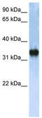 Zinc Finger CCHC-Type Containing 17 antibody, TA341600, Origene, Western Blot image 