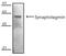 Vesicle Associated Membrane Protein 1 antibody, MA1-25482, Invitrogen Antibodies, Western Blot image 