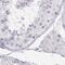 Ornithine Carbamoyltransferase antibody, PA5-51416, Invitrogen Antibodies, Immunohistochemistry paraffin image 