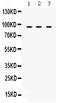 Transporter 1, ATP Binding Cassette Subfamily B Member antibody, PB9823, Boster Biological Technology, Western Blot image 