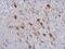 Kinectin 1 antibody, NBP2-15003, Novus Biologicals, Immunohistochemistry paraffin image 