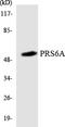 Proteasome 26S Subunit, ATPase 3 antibody, LS-C200536, Lifespan Biosciences, Western Blot image 