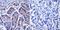 Neurofibromin 1 antibody, GTX15776, GeneTex, Immunohistochemistry paraffin image 