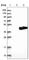 ADP-Ribosylhydrolase Like 2 antibody, HPA027141, Atlas Antibodies, Western Blot image 