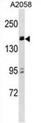 Zinc Finger And BTB Domain Containing 38 antibody, AP54612PU-N, Origene, Western Blot image 