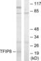 TNF Alpha Induced Protein 8 antibody, LS-B8399, Lifespan Biosciences, Western Blot image 