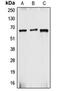 Cytochrome B-245 Beta Chain antibody, orb213813, Biorbyt, Western Blot image 