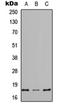 Regenerating Family Member 4 antibody, orb234950, Biorbyt, Western Blot image 