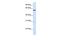 Mannosidase Endo-Alpha antibody, GTX45981, GeneTex, Western Blot image 