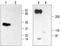 Sodium Voltage-Gated Channel Beta Subunit 2 antibody, TA329032, Origene, Western Blot image 