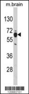 Phosphoglycerate Dehydrogenase antibody, MBS9209434, MyBioSource, Western Blot image 