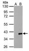 Actin Related Protein 2/3 Complex Subunit 1A antibody, GTX118302, GeneTex, Western Blot image 