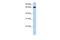 Ectonucleoside Triphosphate Diphosphohydrolase 7 antibody, PA5-43366, Invitrogen Antibodies, Western Blot image 