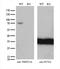 TRNA Methyltransferase 2 Homolog A antibody, M13996, Boster Biological Technology, Western Blot image 