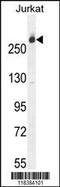 Carbamoyl-Phosphate Synthetase 2, Aspartate Transcarbamylase, And Dihydroorotase antibody, MBS9209870, MyBioSource, Western Blot image 