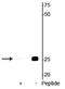 Troponin I3, Cardiac Type antibody, P01720-1, Boster Biological Technology, Western Blot image 