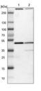 Kelch Domain Containing 8B antibody, NBP1-82703, Novus Biologicals, Western Blot image 