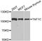 TATA-Box Binding Protein Associated Factor, RNA Polymerase I Subunit C antibody, STJ28842, St John