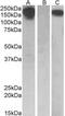 Colony Stimulating Factor 1 Receptor antibody, MBS422533, MyBioSource, Western Blot image 
