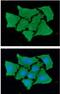Fatty Acid Binding Protein 4 antibody, GTX57547, GeneTex, Immunofluorescence image 