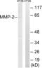 Matrix Metallopeptidase 2 antibody, LS-C118525, Lifespan Biosciences, Western Blot image 