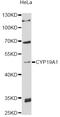 Cytochrome P450 Family 19 Subfamily A Member 1 antibody, LS-C747771, Lifespan Biosciences, Western Blot image 