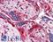 Annexin A11 antibody, LS-B2738, Lifespan Biosciences, Immunohistochemistry paraffin image 