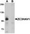 Zinc Finger CCCH-Type Containing, Antiviral 1 antibody, A04199, Boster Biological Technology, Western Blot image 