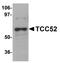 DDB1 And CUL4 Associated Factor 12 antibody, A11802, Boster Biological Technology, Western Blot image 