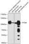 Glycogen Phosphorylase, Muscle Associated antibody, GTX64709, GeneTex, Western Blot image 