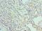Proteasome 26S Subunit, Non-ATPase 5 antibody, LS-B15217, Lifespan Biosciences, Immunohistochemistry paraffin image 