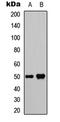 SET And MYND Domain Containing 2 antibody, LS-C358863, Lifespan Biosciences, Western Blot image 