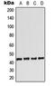 Adenosine A2a Receptor antibody, LS-B14076, Lifespan Biosciences, Western Blot image 