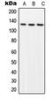 Protein Tyrosine Kinase 2 antibody, GTX32250, GeneTex, Western Blot image 