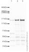 Structural Maintenance Of Chromosomes 3 antibody, ab9263, Abcam, Western Blot image 