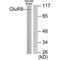 Glutamate Metabotropic Receptor 8 antibody, A06589, Boster Biological Technology, Western Blot image 