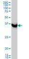 SUMO1 Activating Enzyme Subunit 1 antibody, H00010055-M01, Novus Biologicals, Western Blot image 