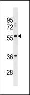 Butyrophilin subfamily 2 member A3 antibody, PA5-49178, Invitrogen Antibodies, Western Blot image 