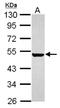 Keratin-5 antibody, NBP2-17038, Novus Biologicals, Western Blot image 