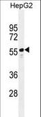 Tetratricopeptide Repeat Domain 6 antibody, LS-C160303, Lifespan Biosciences, Western Blot image 