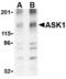 Mitogen-Activated Protein Kinase Kinase Kinase 5 antibody, TA306285, Origene, Western Blot image 